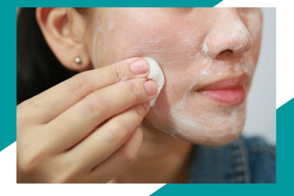 6 Sai lầm khiến mụn càng nặng hơn khi điều trị mụn tại nhà